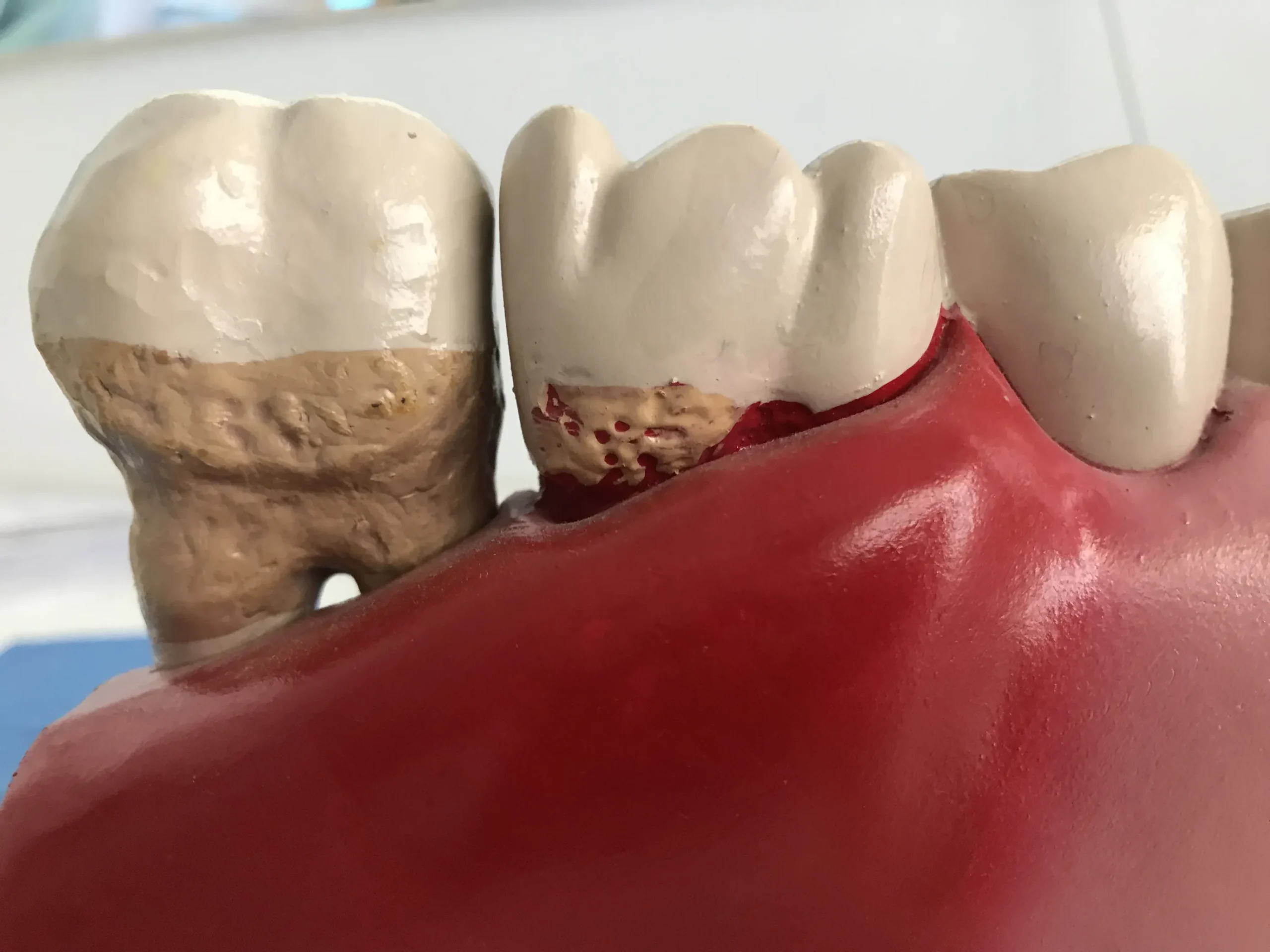 T2 scaled